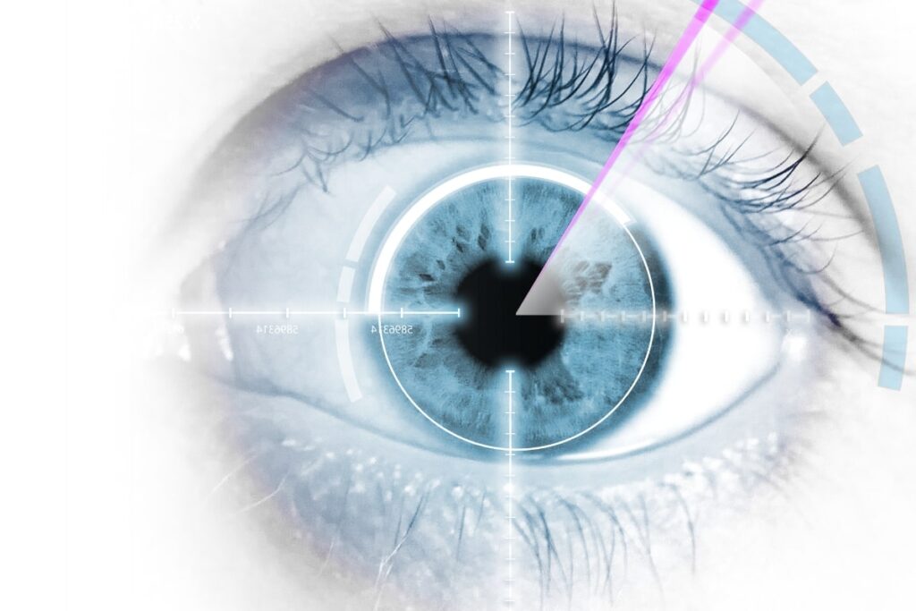 Cirugia Lasik Cancun Provission