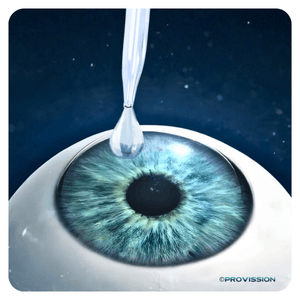 LASIK Cancun – Aplicación de gotas anestésicas en PROVISSIÓN